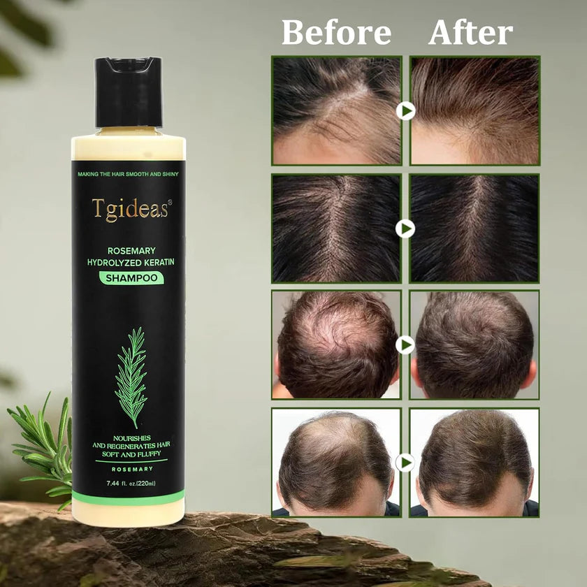 Tgideas® Rosemary Shampoo | Hair Growth & Scalp Treatment